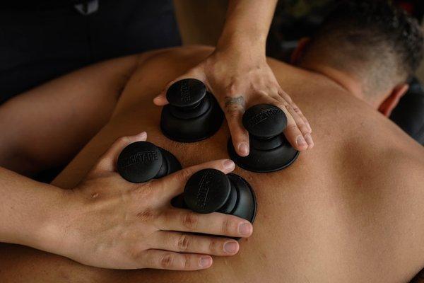 Cupping!