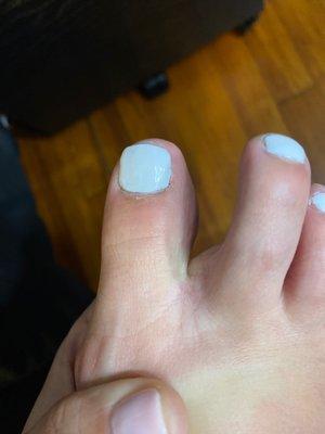 Toe nails