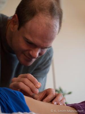 Acupuncturist David Fischer