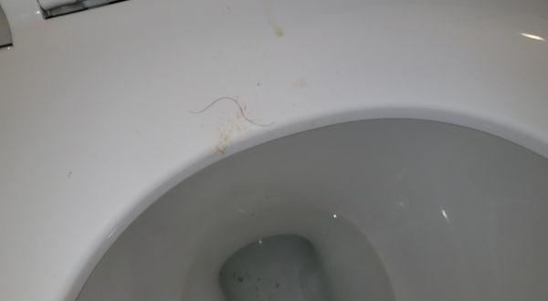 Nasty toilet seat