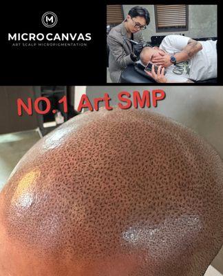 Art SMP Treatment