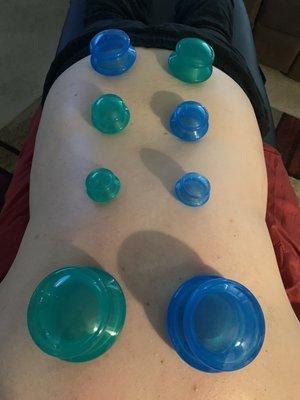 Full back cupping