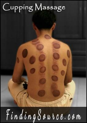 Cupping Massage