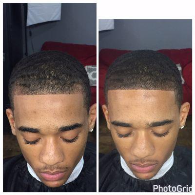 Hairline enhancement