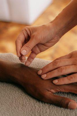 Acupuncturist inserting needles in a treatment session