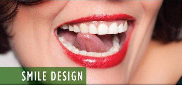 Celebrity Style Smile Design.  Restoration - Teeth Whitening - And More!