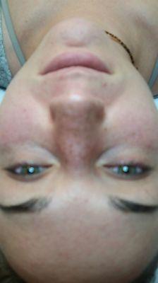 Before eyelash extensions