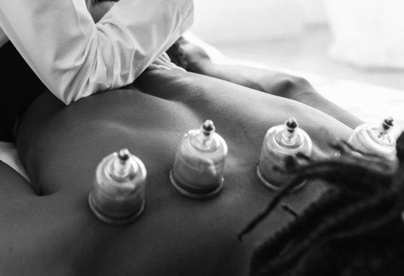 Cupping and manual therapy