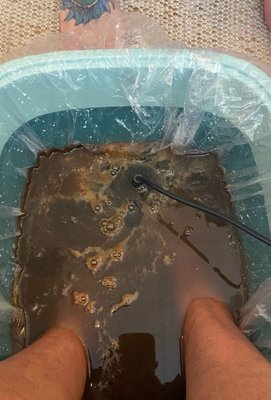 This is 20 of 30 mins into a foot detox treatment.