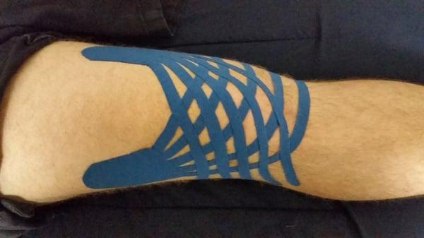 Kinesio Taping used to reduce knee swelling