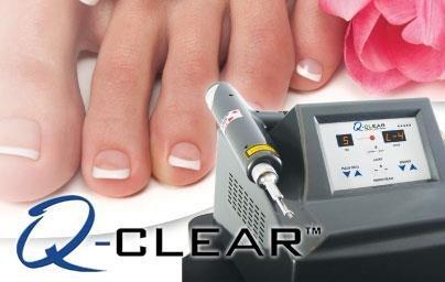 Laser Treatment for Fungal Toenails. If you are concerned about toenail fungus visit our website http://www.onepodiatry.com/