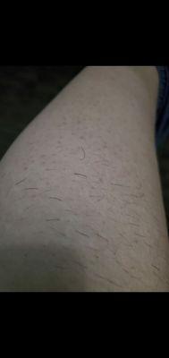 Got my legs waxed and there's still hair left over.