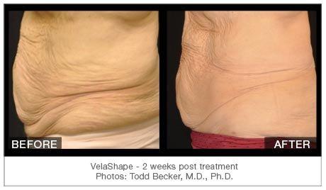 Body Appearances - Your Premier Body Sculpting & Anti-aging Center.