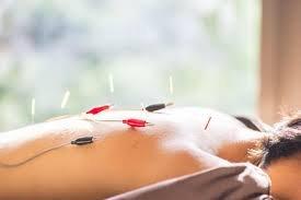 Electro acupuncture uses gentle currents to acupuncture points in order to accelerate healing and promote stress relief to the entire body.