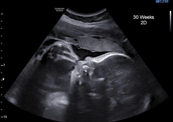 30 Weeks PRofile