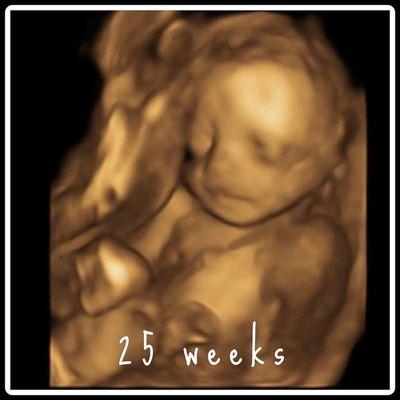 25 weeks