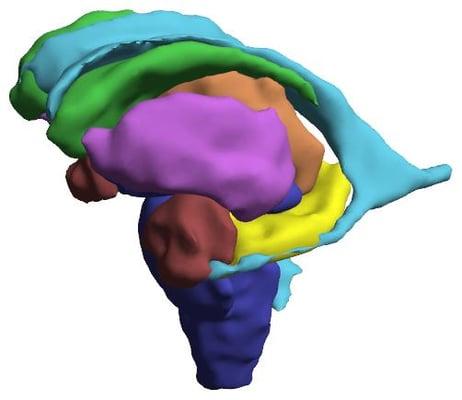 Here is a view of the subcortical structures.