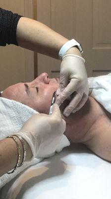 Dermaplaning