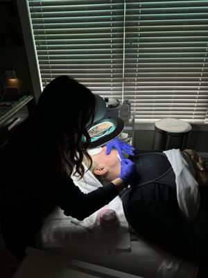 Dermaplaning by Robin at Glow SkinWorks in Matthews, NC.