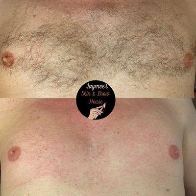 Men's chest wax