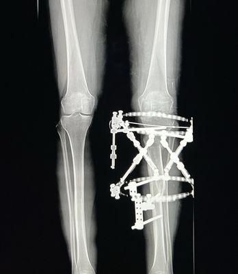 X-ray