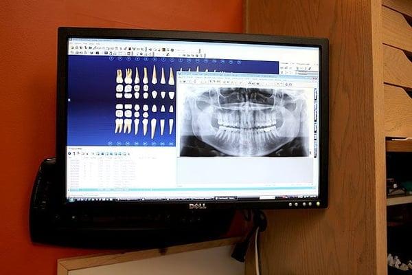 Digital xrays speed up communication and minimize radiation exposure