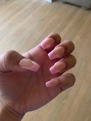 Ugly nails