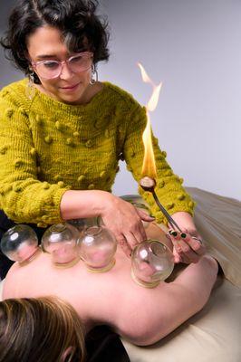 Fire cupping therapy