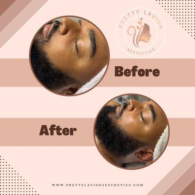 Gentlemen Facial