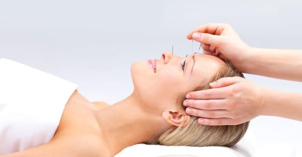 Cosmetic Acupuncture