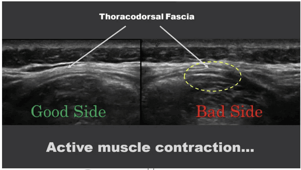 Active Muscle Contraction