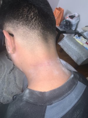 THE BARBERS CUT MY NECK.