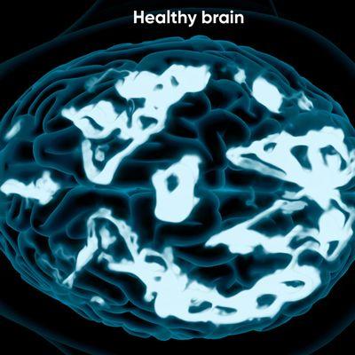 Healthy Brain