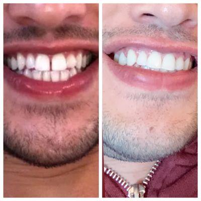 From start to finish Wayne Family Orthodontics changed my life.