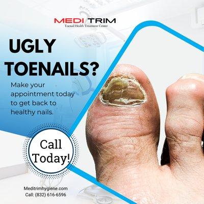 Fungal care, cleaning and toenail fungal care.