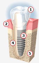 Family Dental Rego Park