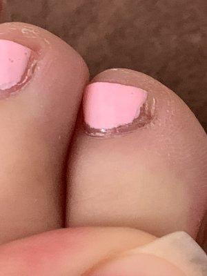 Toes