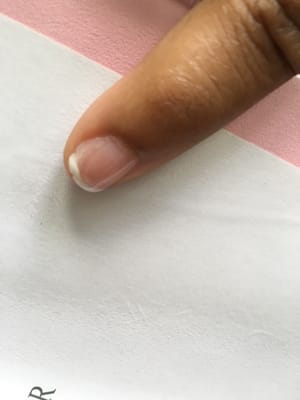 Gel lifting of nail after only 2 days