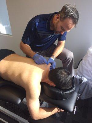 Trigger Point Dry Needling