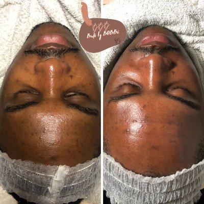 Classic Facial before and after.