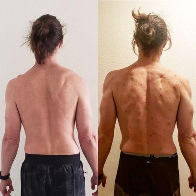 Background in physical therapy helping others with back issues such as scoliosis.