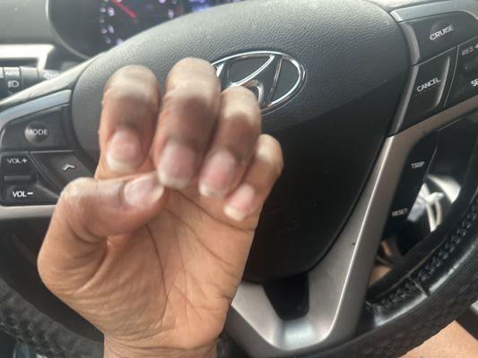 Natural nails