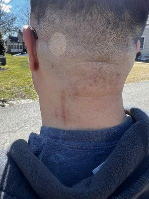 Real Bad Razor cut on my neck.