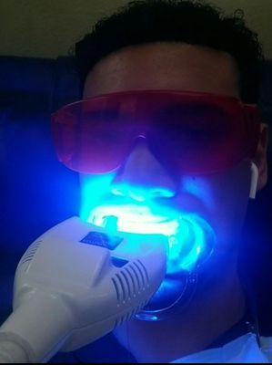 60 minute teeth whitening