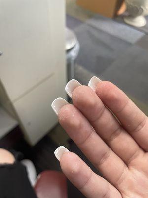 Glue in fingers from nail tech