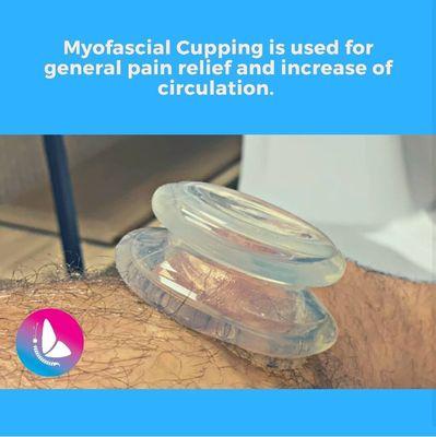 #chiropractor #cupping #chiropractic