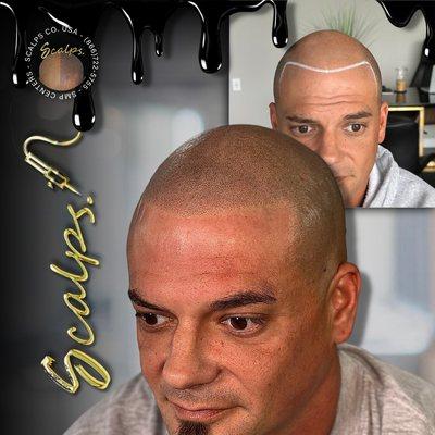 SCALPS - Scalp Micropigmentation Centers