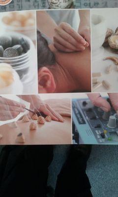 Acupuncture, TCM Massage, Photobiomodulation, Herbal Medicine, Dry Needle