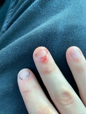 Cut finger from the shelf