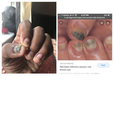 My nails(left) are completely the same to the research I've done. Please be careful!!!!